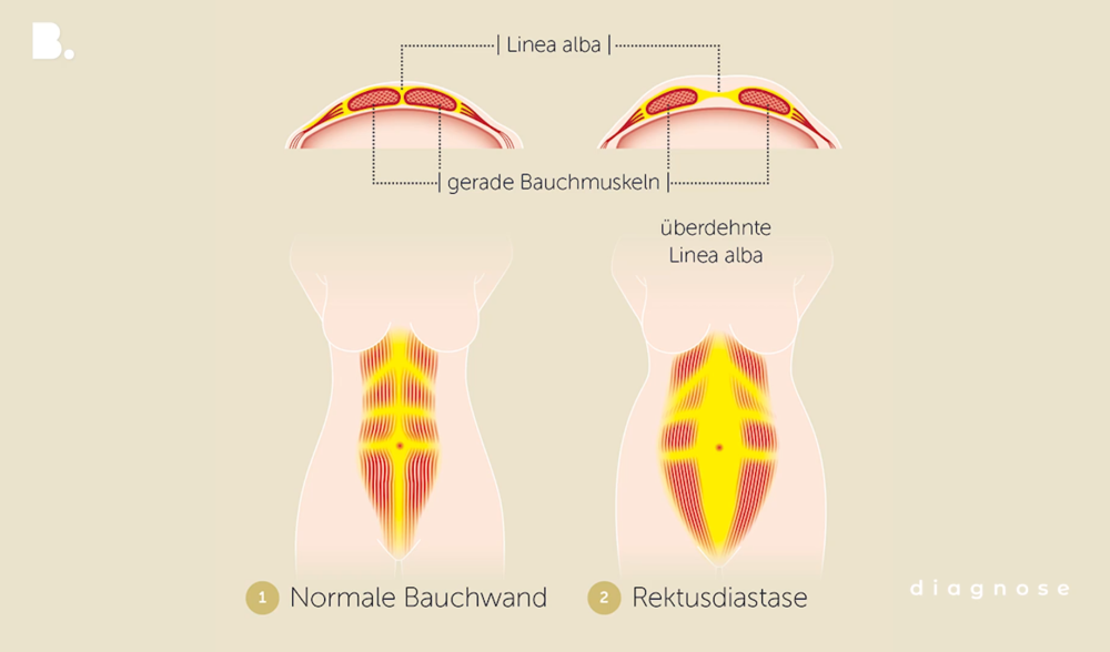 Diagnosesendung