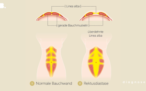Diagnosesendung